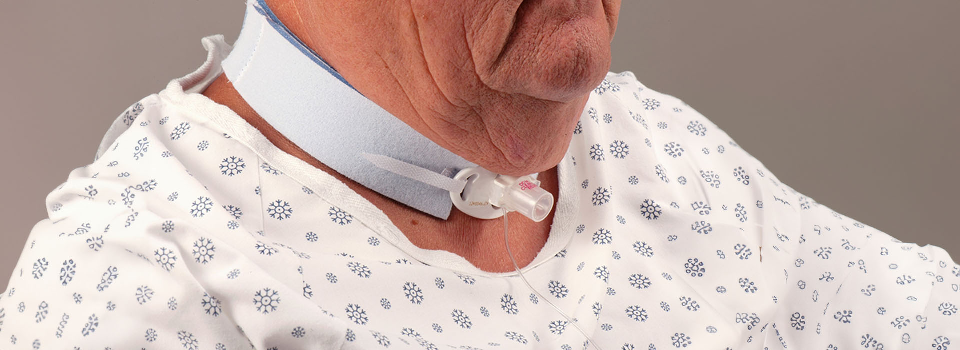 In-Home Tracheostomy Cannula Replacement