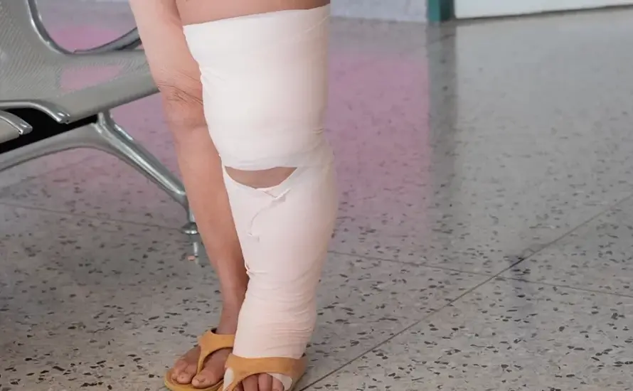 Lymphedema Massage After Surgeries