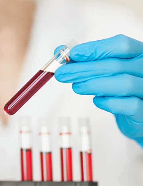 Our In-Home Laboratory Services